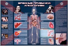 Электрифицированный стенд "Вредные привычки: алкоголизм" - fgospostavki.ru - Сергиев Посад